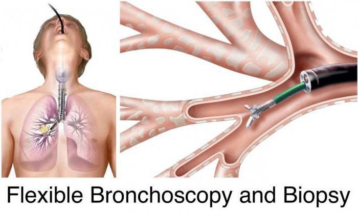 lung biopsy recovery  @ Lung Biopsy: Towards An Appointment, Outcome And Outcome