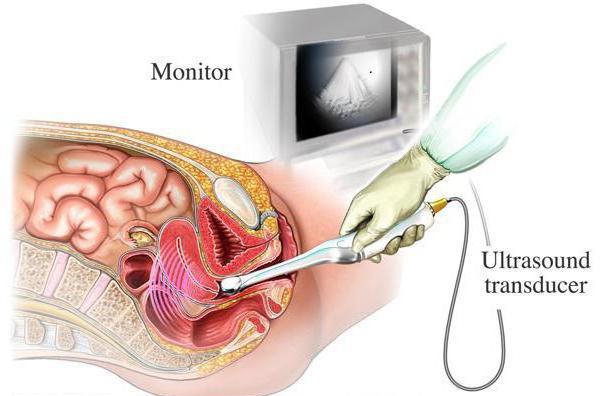 Menga chuqur kirishingni xohlayman Katta braziliyalik eshaklar harakatda xxx