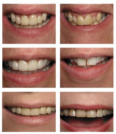 Ең терең қынапшасы барлар үшін порно жарыстар Көшеде жалаңаш дененің суреті