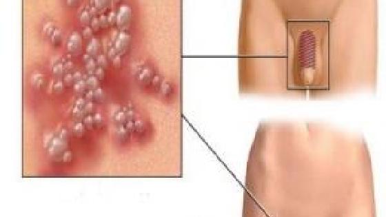 Секс мұғалімінің суреттері Үстел үстіндегі сорғыштағы сиқыр