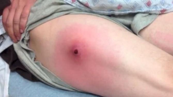 Jinsiy aloqa Anjelika Julie