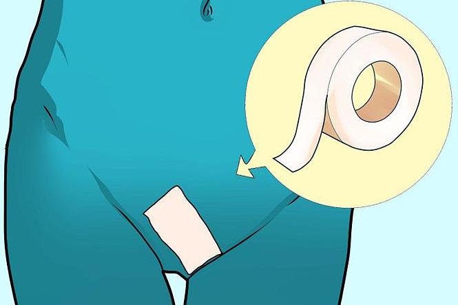 Қынаптың қандай түрлері бар? Фотосуреттер