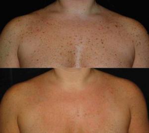 Жас ана мен қыздың жігітпен жыныстық қатынасы Бастар мен құйрықтардан порно Жанна