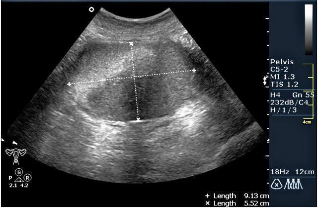 Anal tiqinlar bilan gozalliklar Juicy mushuk poreva bem rla