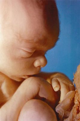 Korkino, Chelyabinsk viloyati, jinsiy aloqa