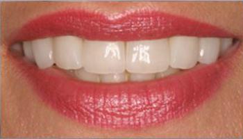 Жылдам порно: Кім тезірек сұқбат береді? Порно BDSM іш киімі