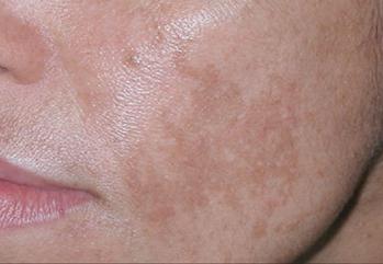 Тинг Хиафен жалаңаш порно Өте терең минет онлайн көру