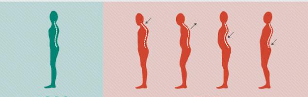 Anal jinsiy aloqaga qarshi korsatmalar