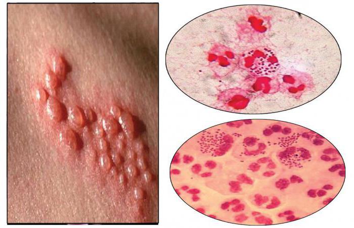 Күйші байқаусызда сиқты көріп қалды