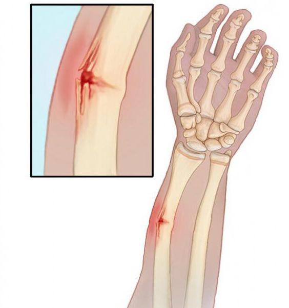 Tratamentul articulației Vityazevo Balsam regenerator pentru ligamente pentru oase și articulații