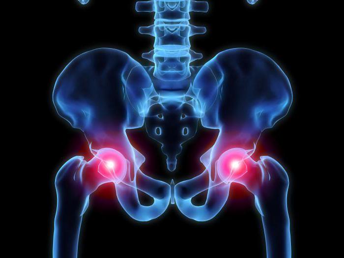 artróza a strava ameliorarea durerii în articulația gleznei