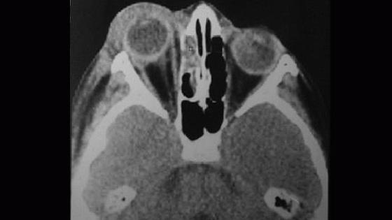 Жас аналардың жыныстық қатынасқа түсуі туралы порно видеолар