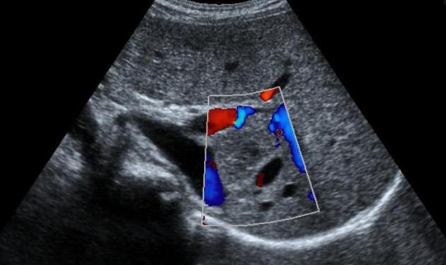 Anfisa Vistingauzen erotik fotosuratlar